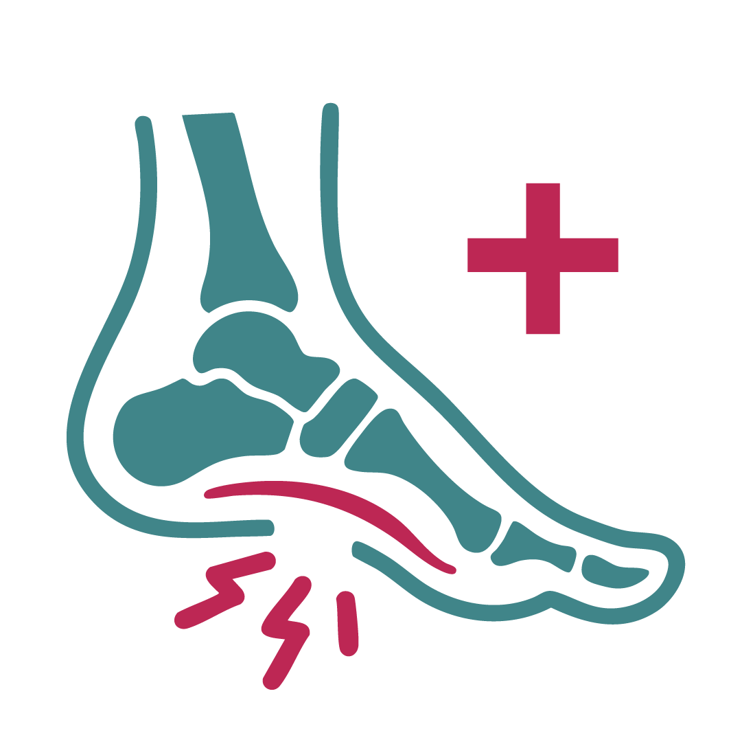 Lindert Schmerzen bei Plantarfasziitis